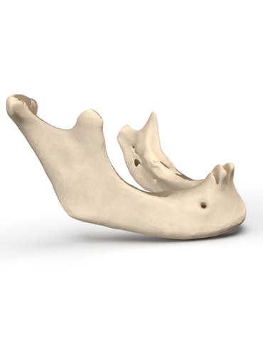 Bone segmentation