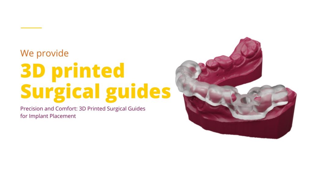 surgical guides